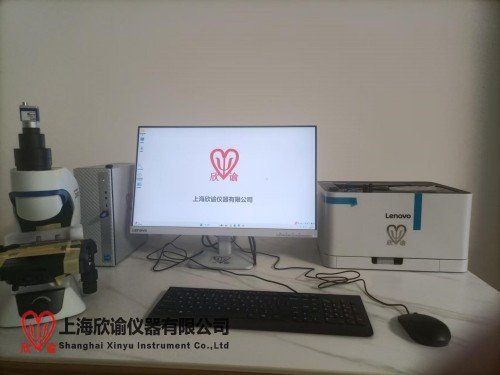 染色体畸变分析系统：精准医学时代的核心技术支撑